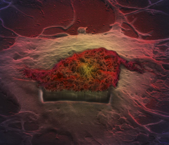 Brain astrocyte cell taking up carbon nano-needles, SEM Khuloud T. al-Jamal, Serene Tay, Michael Cicirko