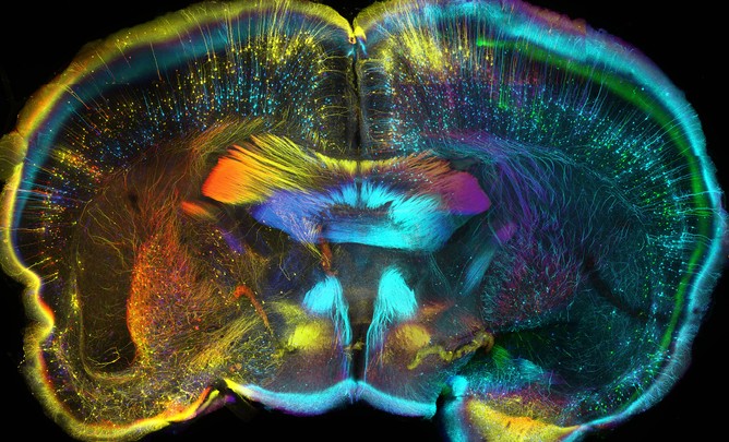 Mouse brain, coronal view. Luis de la Torre-Ubieta