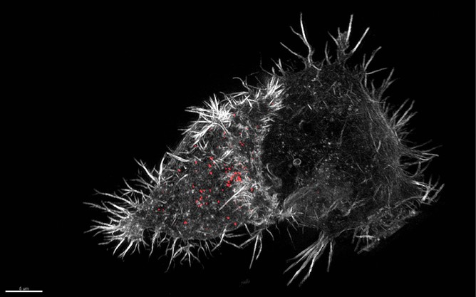 Natural killer (NK) cell immune synapse, 3D-SIM Dieckermann and Lawrence, Cambridge University