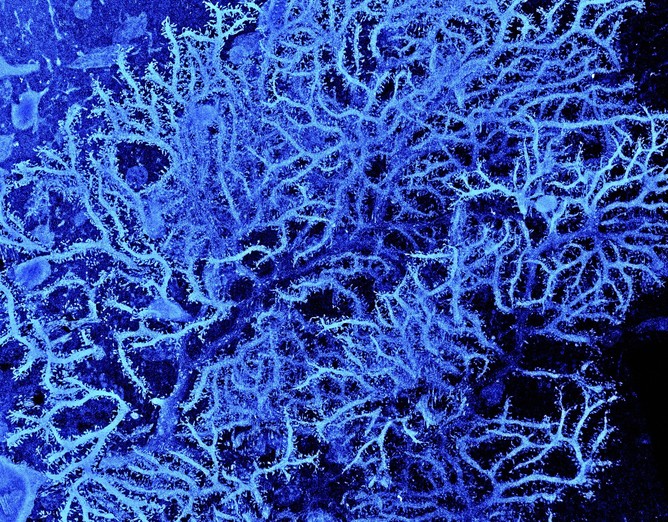 Purkinje cell and dendritic tree, rat cerebellar cortex, SEM Michael Hausser/Sarah Rieubland/Arnd Roth/UCL
